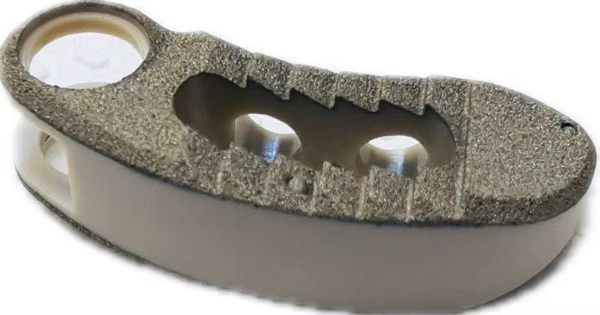 Coated TLIF PEEK Cage