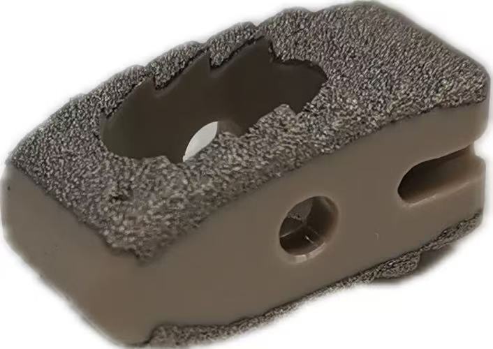 Coated Oblique PEEK Cage
